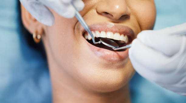 Best Emergency Dental Extractions in Wheaton, MD